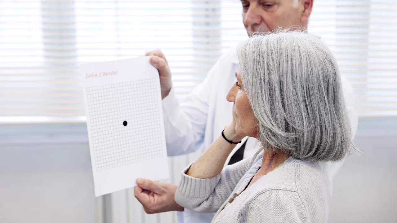 Macular Degeneration (Age-Related Macular Degeneration)