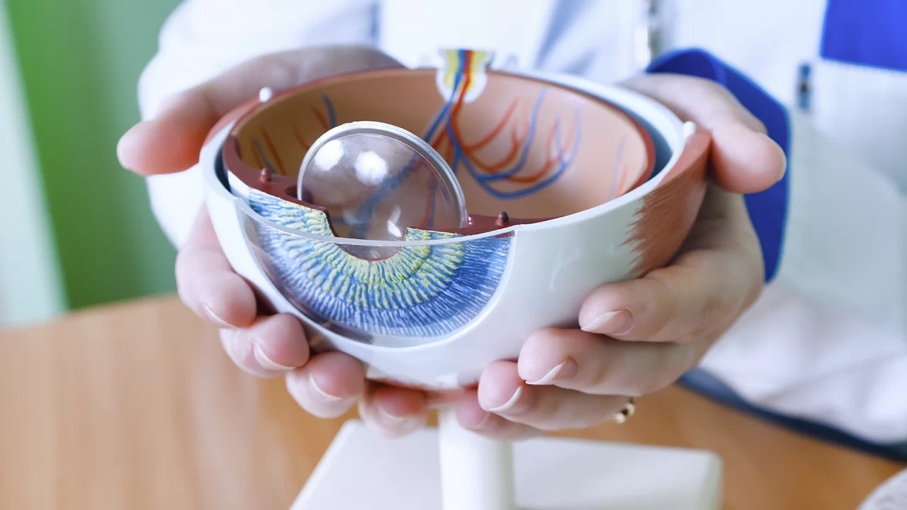 Secondary Intraocular Lens Applications (Scleral-Sutured)